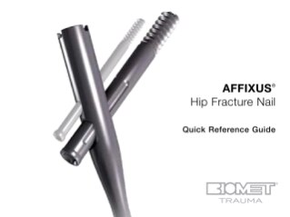 Discover more than 127 biomet femoral nail latest - ceg.edu.vn
